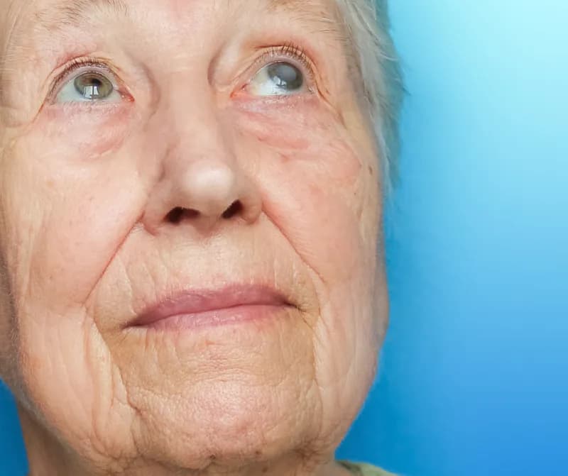 Po zabiegu zaćmy kiedy można prowadzić samochód bez ryzyka?