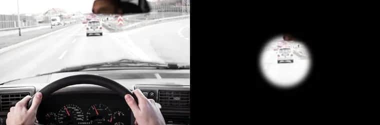 Jak widzi osoba z jaskrą? Zrozumienie utraty wzroku i jej skutków