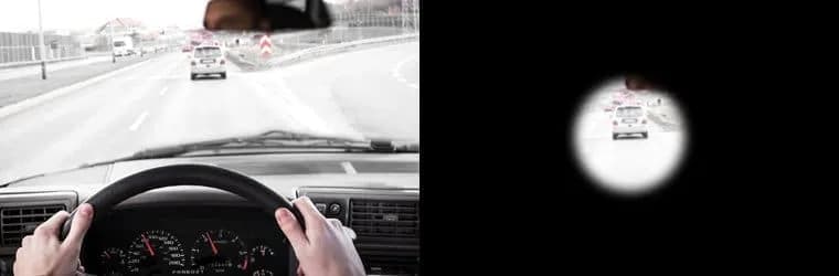 Jak widzi osoba z jaskrą? Zrozumienie utraty wzroku i jej skutków