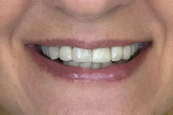 Czy podczas okresu można iść do dentysty bez obaw o ból?