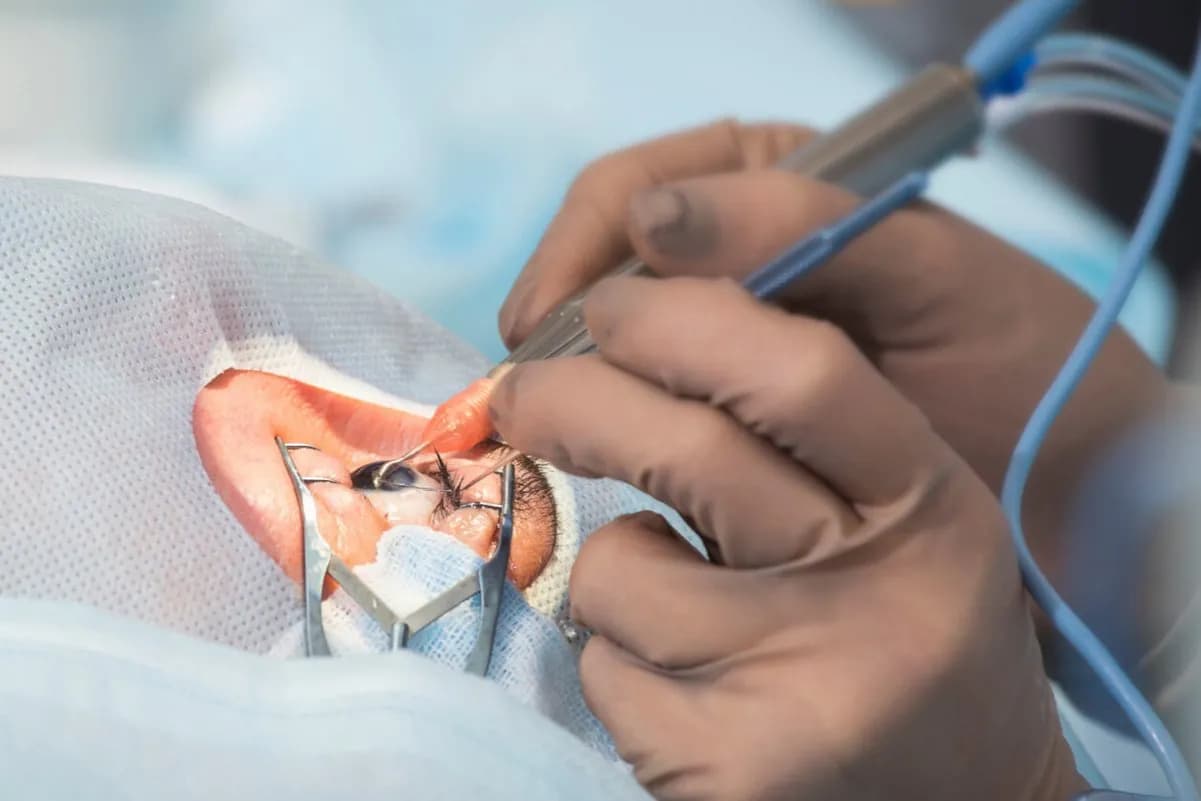 Na czym polega usunięcie zaćmy? Kluczowe informacje o zabiegu