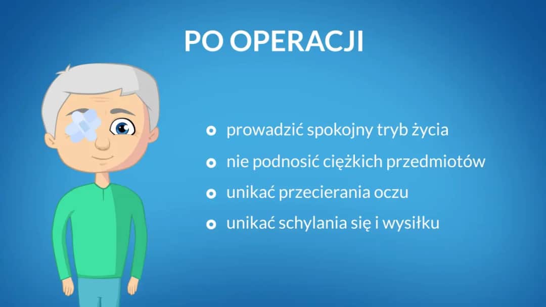 Jak długo nie można dźwigać po operacji zaćmy, aby uniknąć komplikacji?