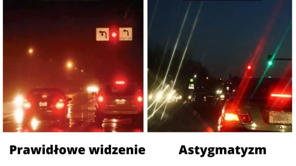 Astygmatyzm co to za wada? Objawy, przyczyny i skuteczne leczenie