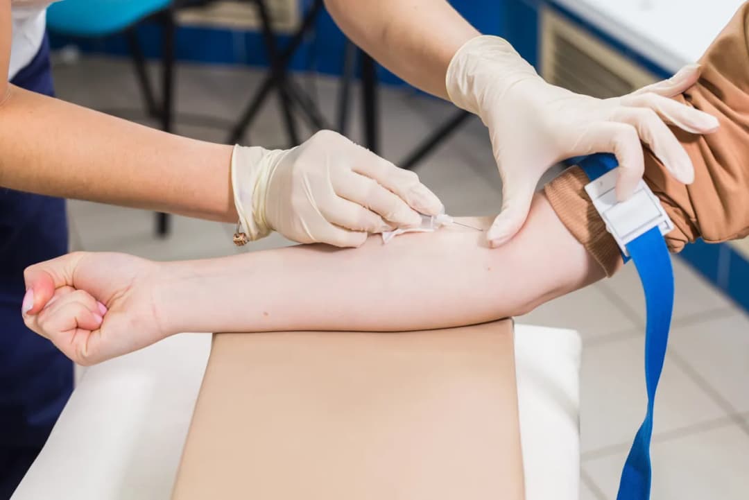 Jakie badania krwi przed wizytą u urologa? Kluczowe informacje dla zdrowia