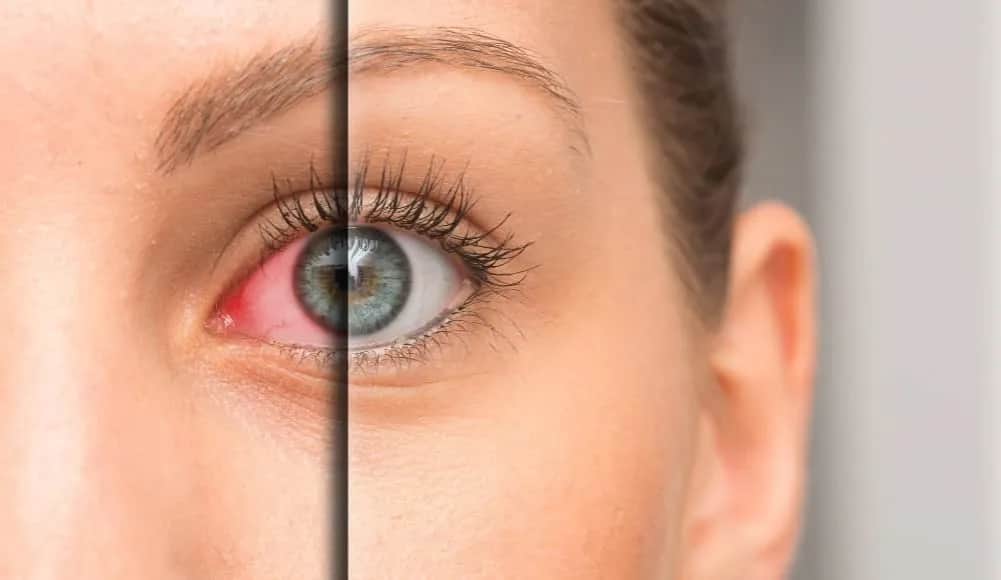 Choroby wzroku objawy: Jak rozpoznać niebezpieczne symptomy?