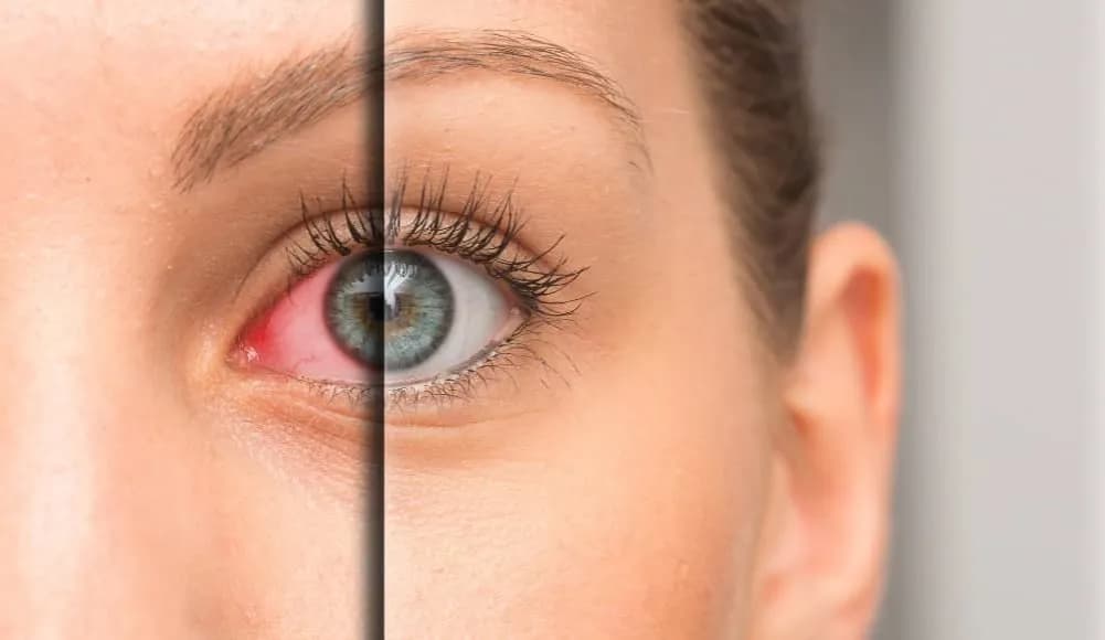 Choroby wzroku objawy: Jak rozpoznać niebezpieczne symptomy?