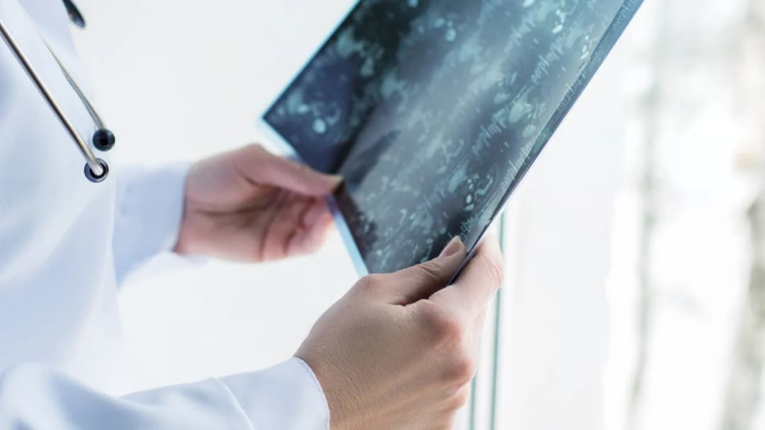 Kto może wystawić skierowanie na rezonans magnetyczny kręgosłupa? Sprawdź to!