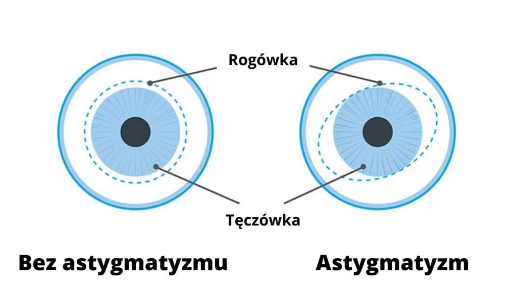Astygmatyzm: okulista czy optometrysta? Który specjalista pomoże?