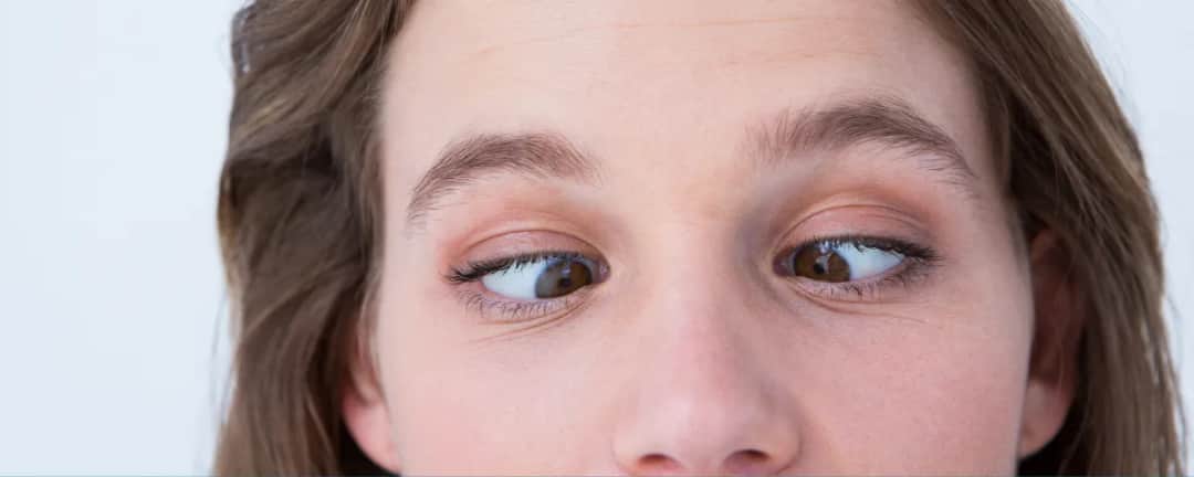 Czy zez jest dziedziczny? Poznaj genetyczne aspekty i ryzyko w rodzinie