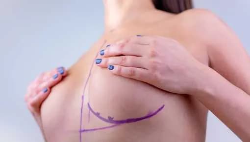 Proteza piersiowa NFZ co ile lat? Sprawdź zasady refundacji i wyjątki