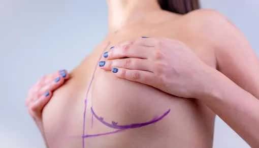 Proteza piersiowa NFZ co ile lat? Sprawdź zasady refundacji i wyjątki