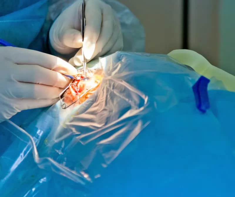 Gdzie najlepiej zrobić operację zaćmy, aby uniknąć długich kolejek?