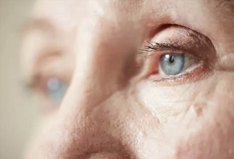 Zaćma wikłająca - co to jest, objawy, przyczyny i leczenie